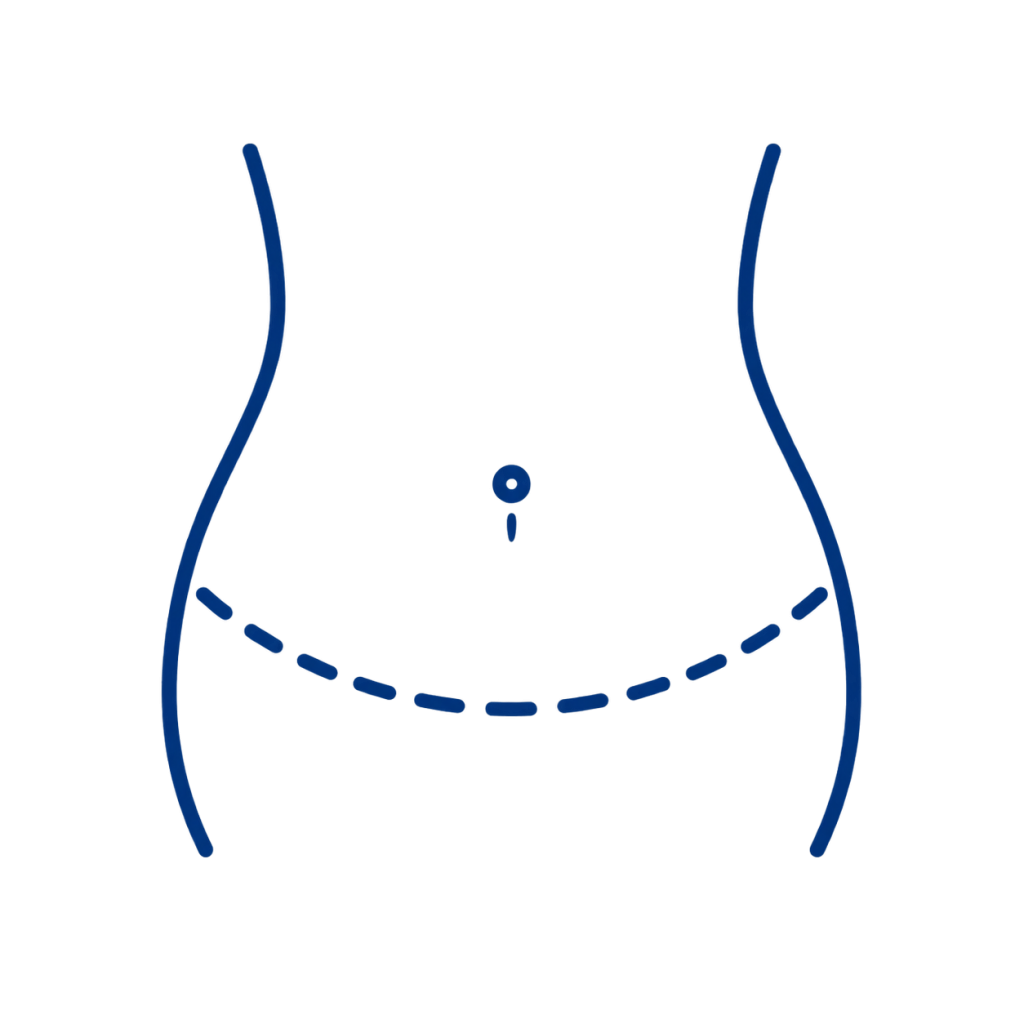 Icono que representa un abultamiento del abdomen