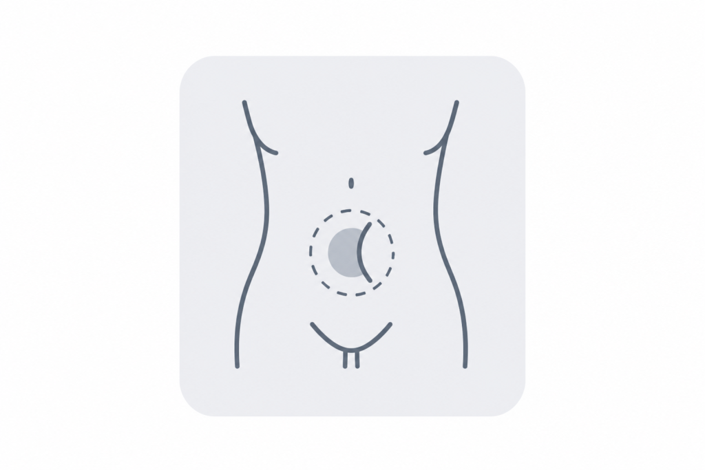 Icono médico de hernia abdominal