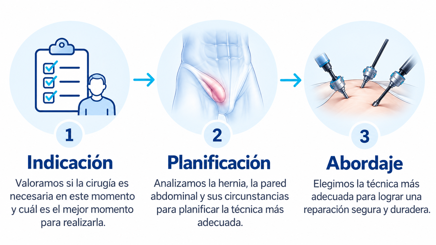 Infografía médica_ cirugía de hernia inguinal
