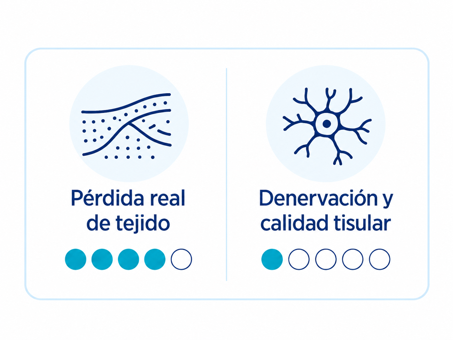 perdida ES